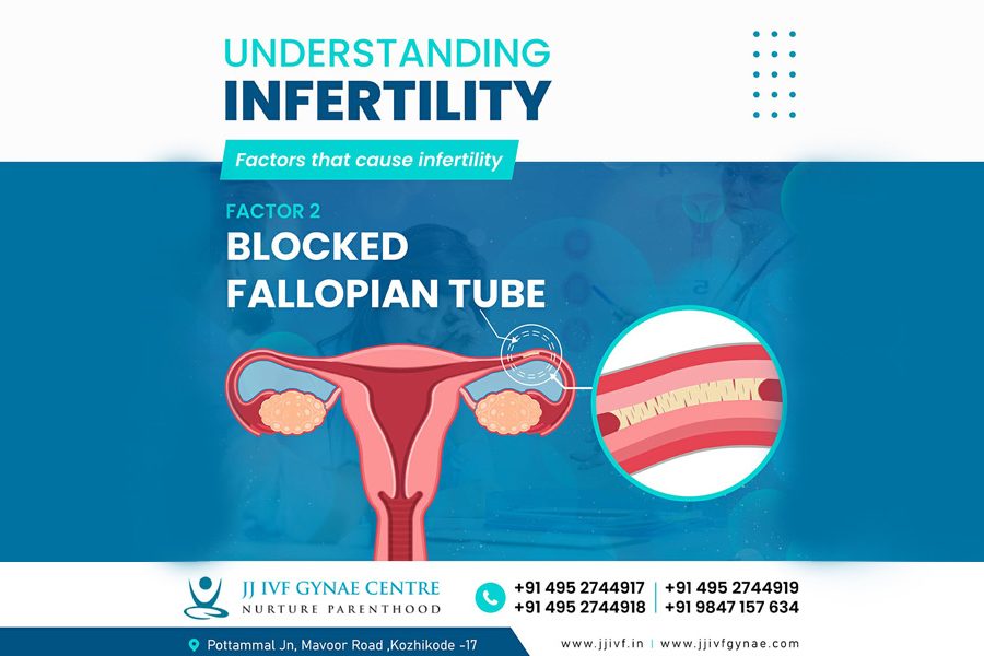 Blocked Fallopian Tube