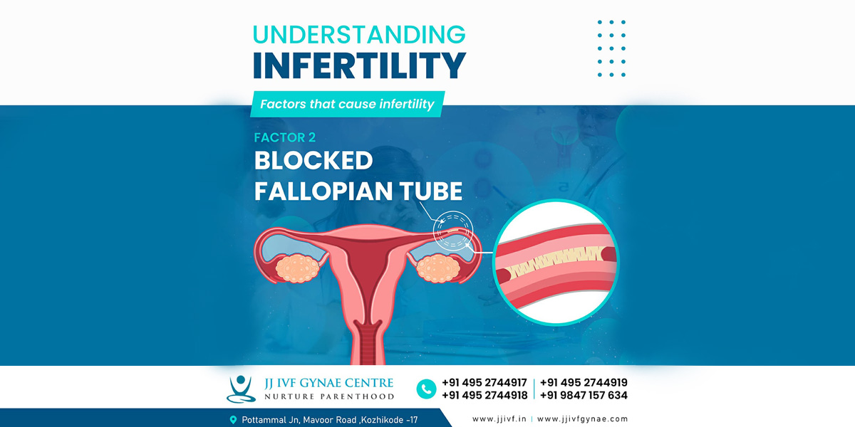 Blocked Fallopian Tube
